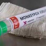 Mpox Virus: A Growing Global Concern and Pakistan’s Challenge Mpox Virus: A Growing Global Concern and Pakistan’s Challenge