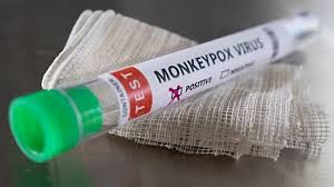 Mpox Virus: A Growing Global Concern and Pakistan’s Challenge Mpox Virus: A Growing Global Concern and Pakistan’s Challenge