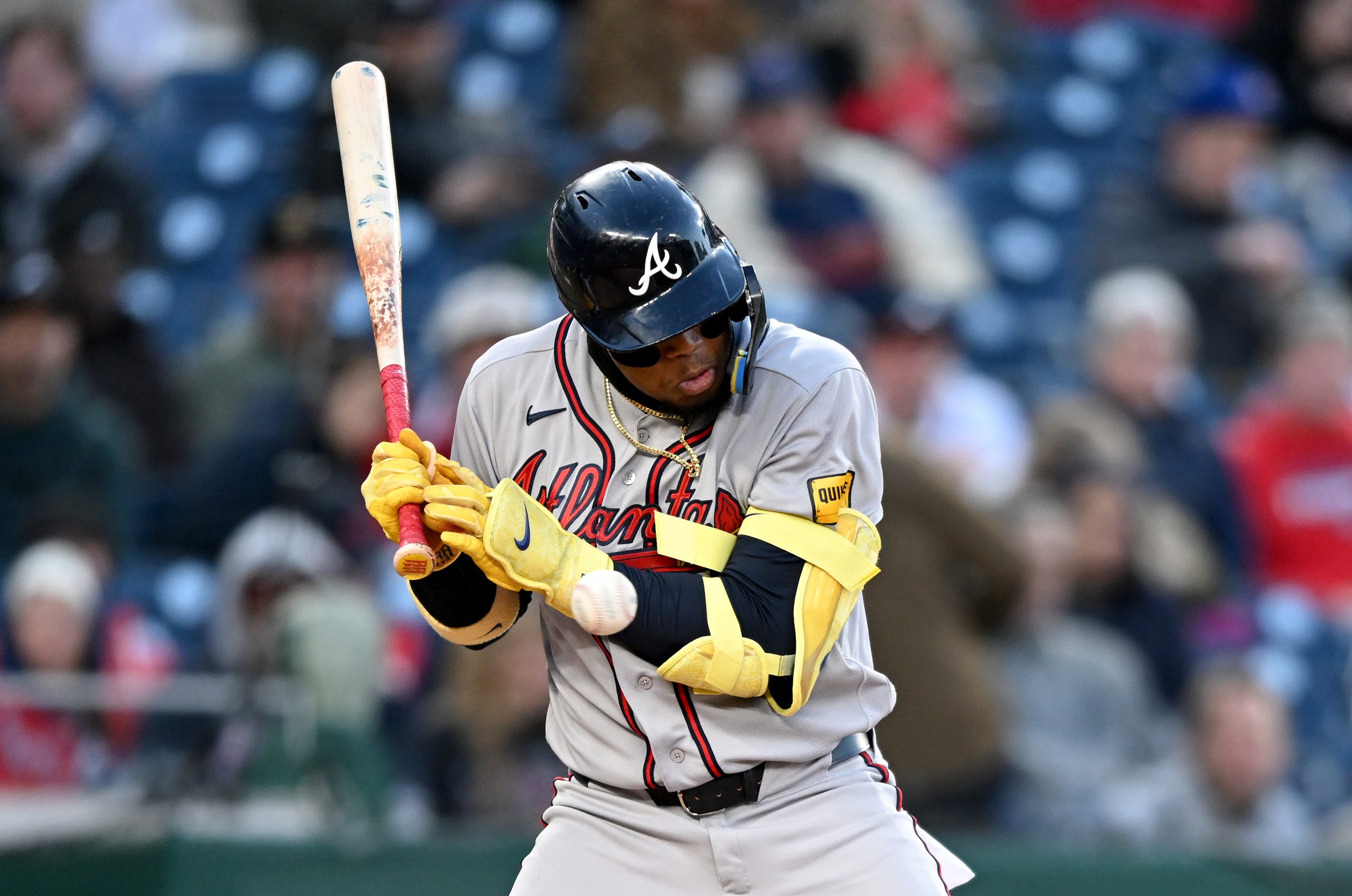 Atlanta Braves Triumph Over Nationals 9-4; Ronald Acuña Jr. Suffers Injury Scare, X-Rays Negative Atlanta Braves Triumph Over Nationals 9-4; Ronald Acuña Jr. Suffers Injury Scare, X-Rays Negative