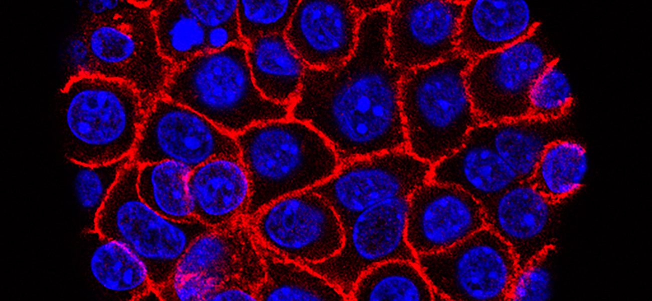 A ‘Death Sentence’ Deferred? Pancreatic Cancer Pill Offers Whispers of Hope