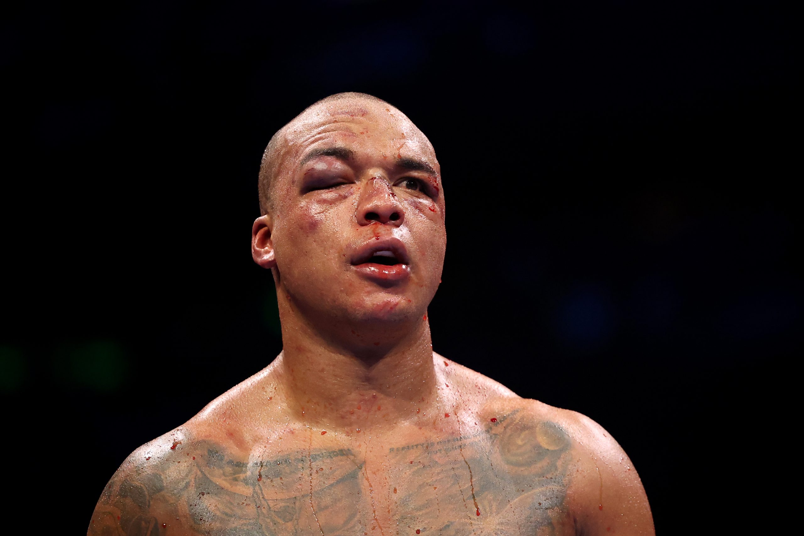 The Brutality Tax: When Boxing’s Glory Comes Drenched in Red