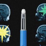 Ozempic’s Brain Tease: The Unseen Costs of Appetite Suppression Ozempic’s Brain Tease: The Unseen Costs of Appetite Suppression
