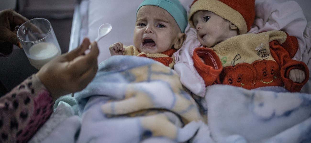 Kabul’s Silent Attrition: Child Malnutrition Surges as Afghanistan Slips from Global View Kabul’s Silent Attrition: Child Malnutrition Surges as Afghanistan Slips from Global View