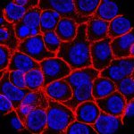 Pancreatic Cancer’s ‘Undruggable’ Curse Meets its Match: A New Pill’s Unsettling Promise Pancreatic Cancer’s ‘Undruggable’ Curse Meets its Match: A New Pill’s Unsettling Promise