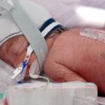 Australian Woman Delivers Identical Quadruplet Girls in Rare Pregnancy