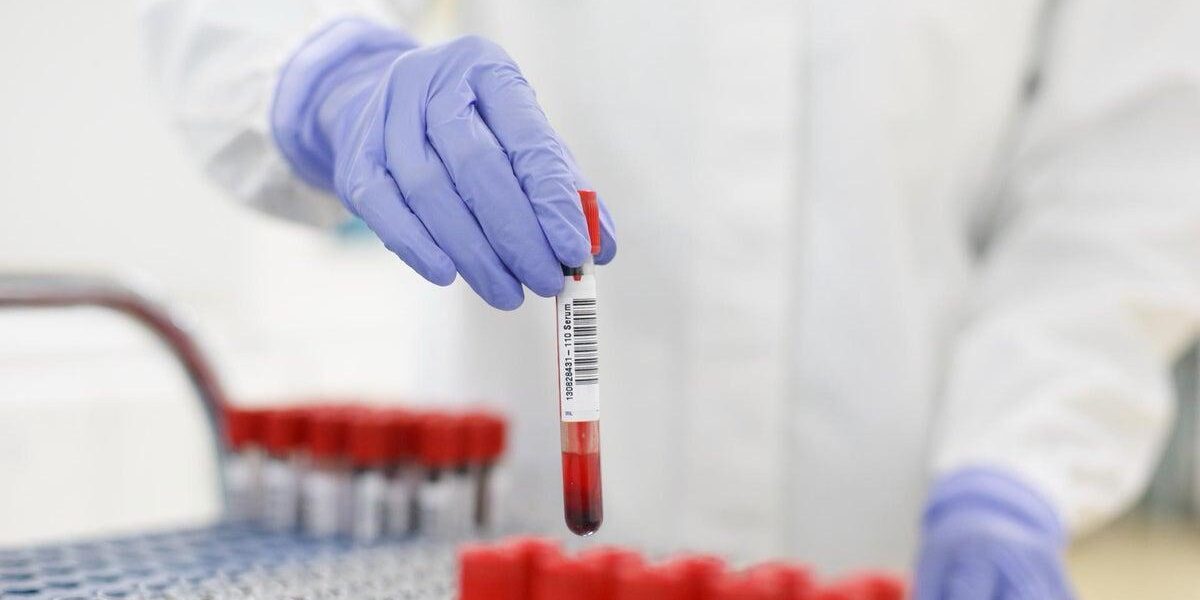 Revolutionary Blood Test Offers Early Detection of Debilitating Disease Revolutionary Blood Test Offers Early Detection of Debilitating Disease