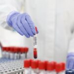 Revolutionary Blood Test Offers Early Detection of Debilitating Disease