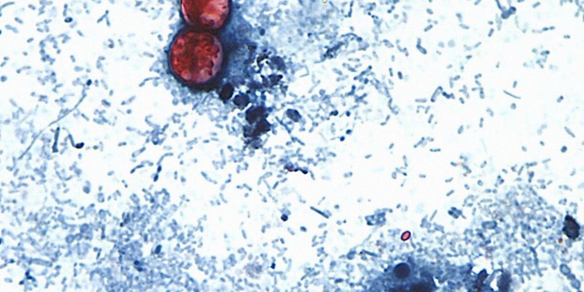 UK Issues Holiday Warning as Cyclospora Outbreak Spreads UK Issues Holiday Warning as Cyclospora Outbreak Spreads