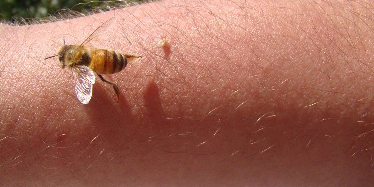 Savannah Spoor Turns to Bee Venom Therapy for Lyme Disease Symptoms Savannah Spoor Turns to Bee Venom Therapy for Lyme Disease Symptoms