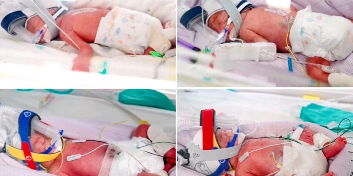 Mother Delivers Rare Identical Quadruplets in Astonishing ‘One in 15 Million’ Birth Mother Delivers Rare Identical Quadruplets in Astonishing ‘One in 15 Million’ Birth