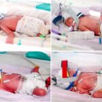 Mother Delivers Rare Identical Quadruplets in Astonishing ‘One in 15 Million’ Birth