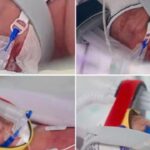 Australian Woman Delivers Identical Quadruplet Girls in Rare Pregnancy Australian Woman Delivers Identical Quadruplet Girls in Rare Pregnancy