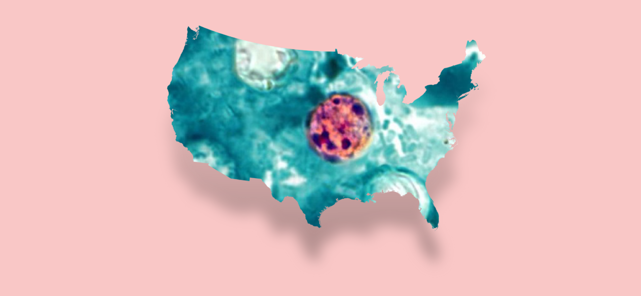Michigan’s Cyclosporiasis Quagmire: Bureaucratic Lag Casts Long Shadow Michigan’s Cyclosporiasis Quagmire: Bureaucratic Lag Casts Long Shadow