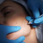 Botox Injections for TMJ Pain Relief Surge Among Young Women