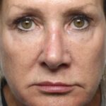 Pamela Gwinnett Arrested for £300,000 Fraud Against Vulnerable Pensioner