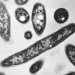 Metropolitan Museum Contends with Microbe Outbreak as NYC Battles Legionnaires’ Scare Metropolitan Museum Contends with Microbe Outbreak as NYC Battles Legionnaires’ Scare
