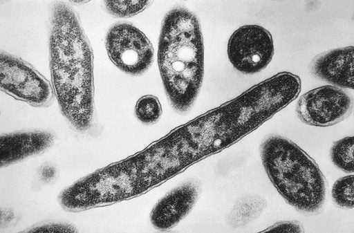 Metropolitan Museum Contends with Microbe Outbreak as NYC Battles Legionnaires’ Scare Metropolitan Museum Contends with Microbe Outbreak as NYC Battles Legionnaires’ Scare