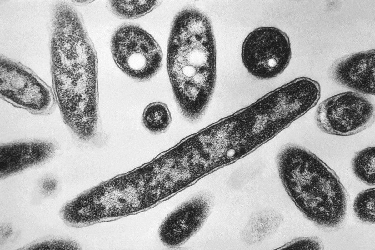 First Fatality Reported in NYC Legionnaires’ Disease Outbreak First Fatality Reported in NYC Legionnaires’ Disease Outbreak