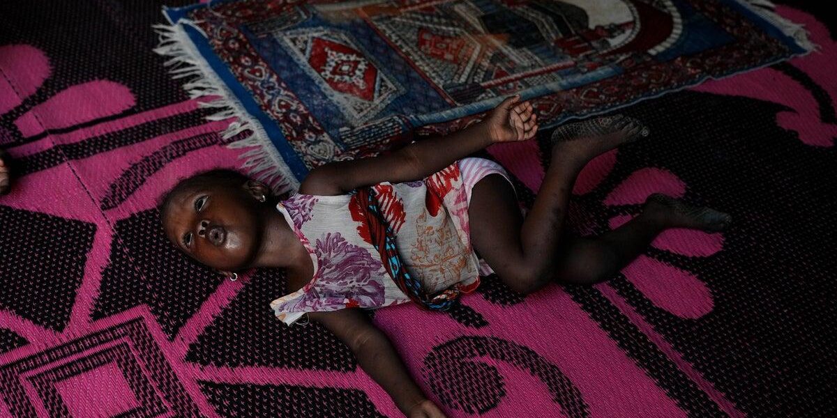 Nigerian Children Suffer from Surging Malnutrition Amid Middle East Conflict Nigerian Children Suffer from Surging Malnutrition Amid Middle East Conflict