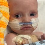 Infant Defies Odds: Thriving Post Life-Saving Heart Surgery Infant Defies Odds: Thriving Post Life-Saving Heart Surgery