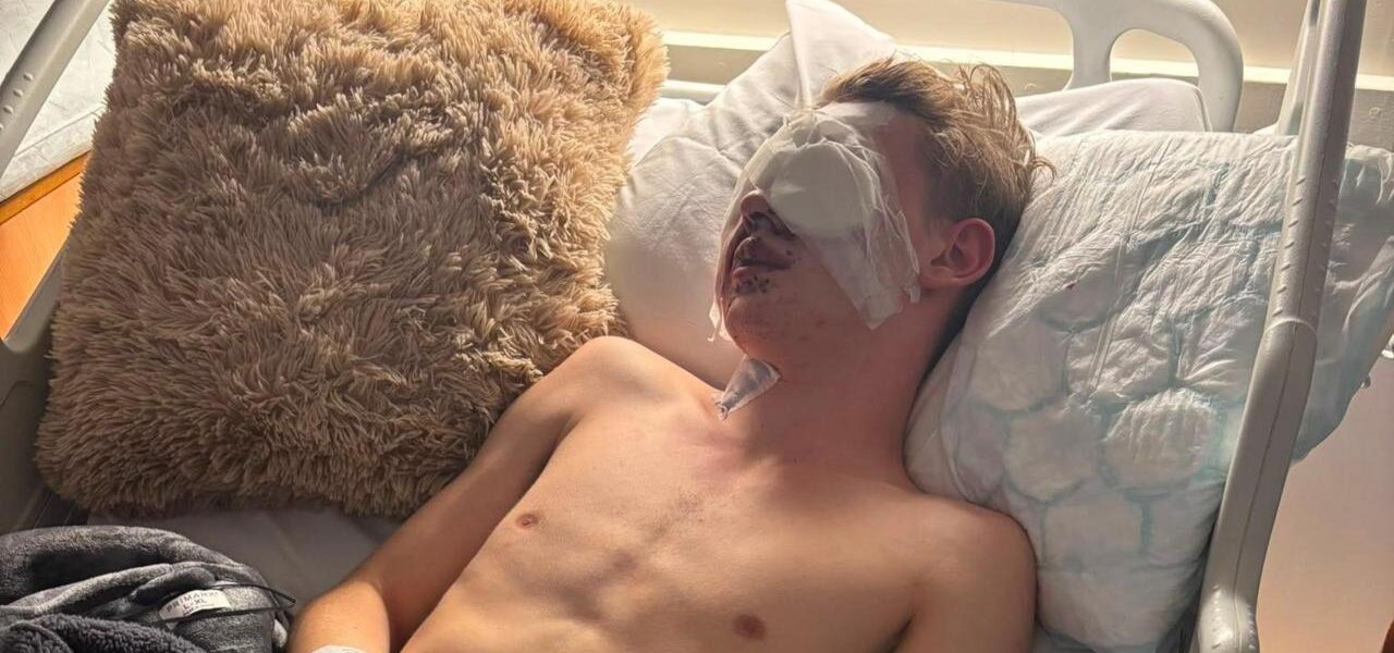 Injured Teen Advocates for Firework Sales Ban After Blinding Accident