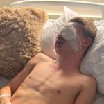 Injured Teen Advocates for Firework Sales Ban After Blinding Accident