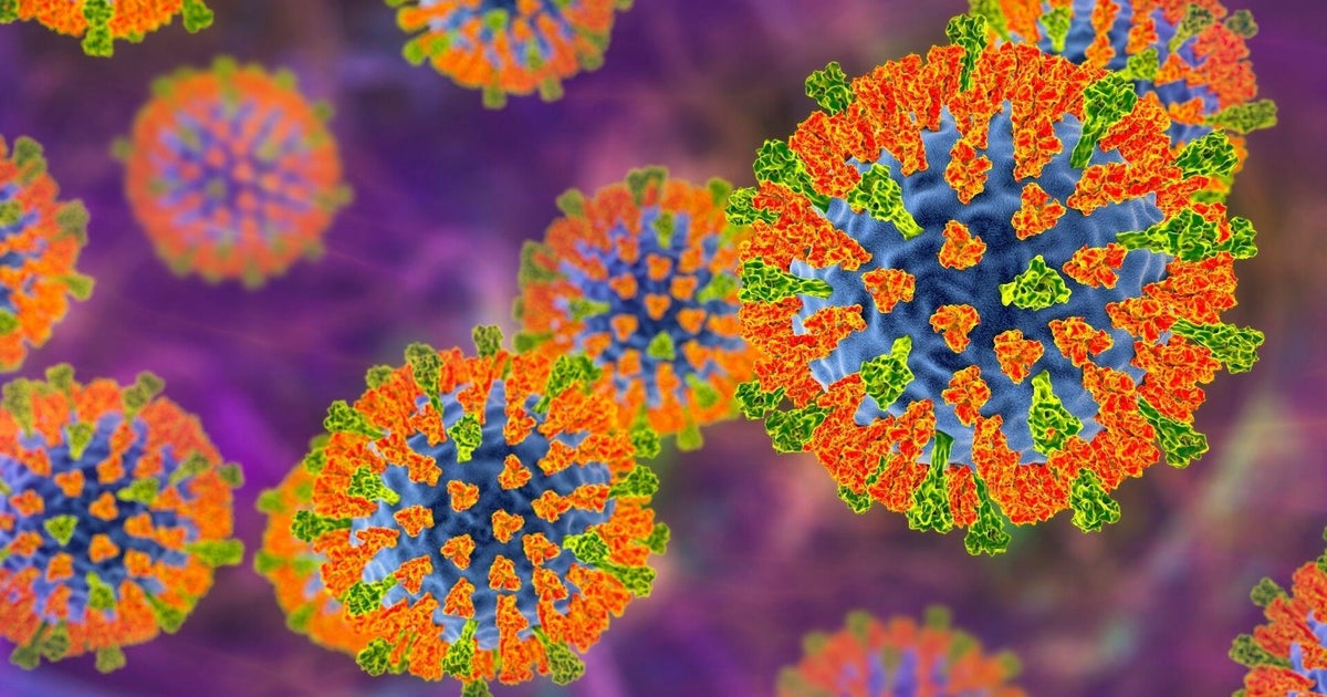 Pennsylvania Woman Dies from Measles Complications, Jefferson County Coroner Confirms