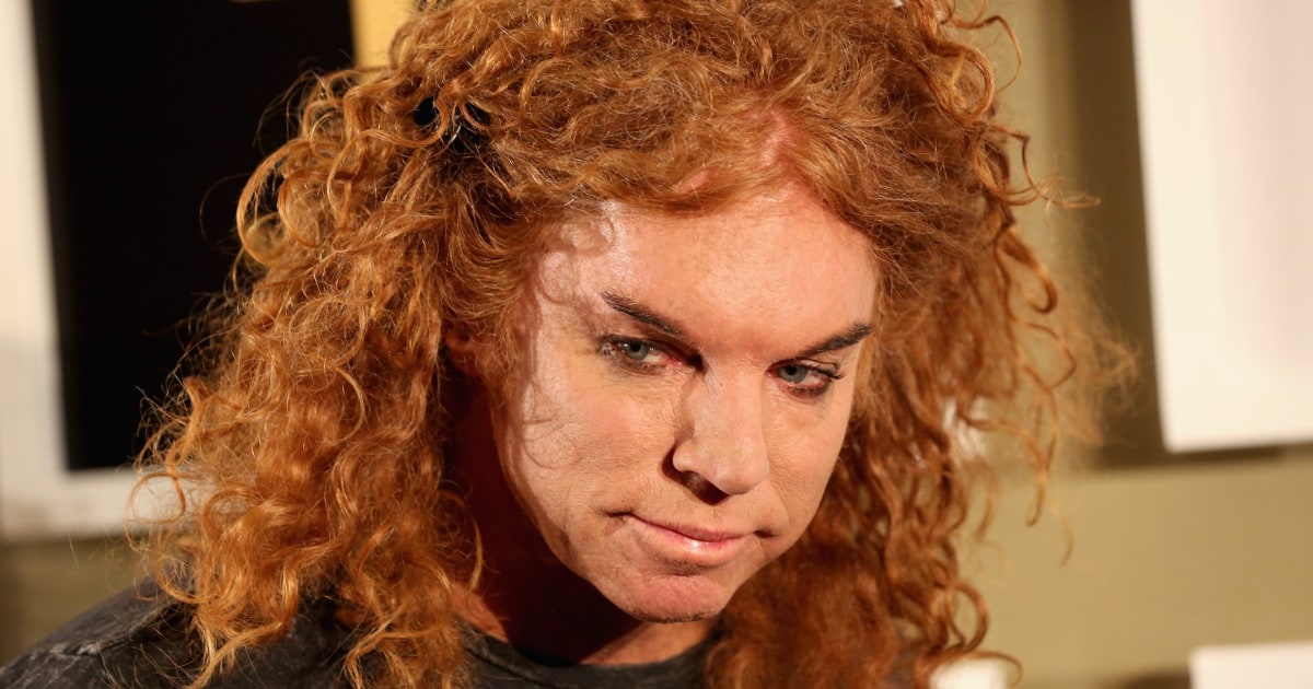 Comedian Carrot Top Hospitalized, Representative Confirms Recovery