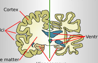 POLICY WIRE FACT CHECK: Viral Newsletter Claims Genetic Discovery Reverses Alzheimer’s Brain Damage POLICY WIRE FACT CHECK: Viral Newsletter Claims Genetic Discovery Reverses Alzheimer’s Brain Damage