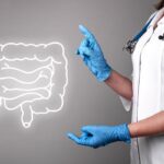 Five Silent Bowel Cancer Symptoms Experts Urge You Not to Ignore