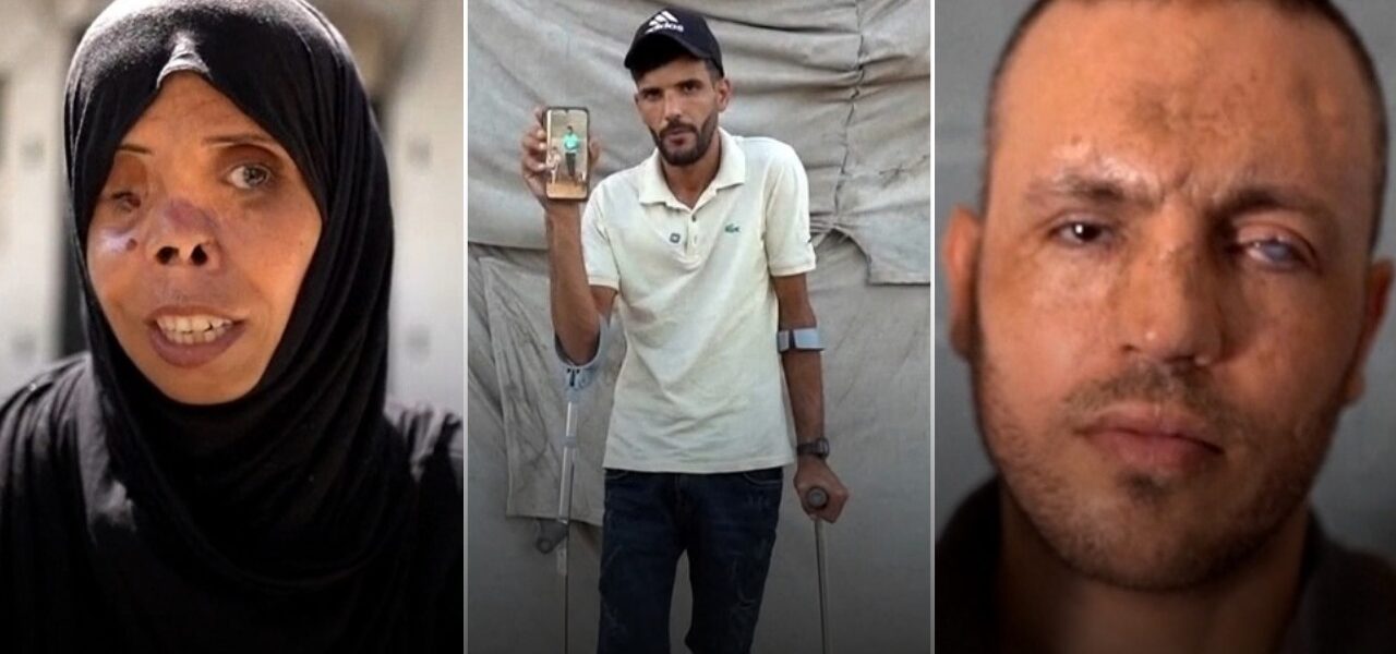 The Lasting Toll: Gaza Residents Grapple With Life-Altering War Injuries The Lasting Toll: Gaza Residents Grapple With Life-Altering War Injuries