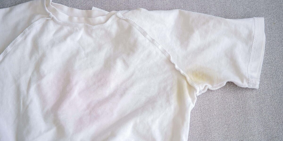 How to Remove Yellow Stains from White Clothes: Expert Tips