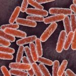 Woman in Russia Dies from Mysterious Illness; Pneumonic Plague Concerns Rise Woman in Russia Dies from Mysterious Illness; Pneumonic Plague Concerns Rise