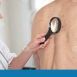 Dermatologist Expert Shares Essential Strategies for Reversing Skin Damage and Preventing Cancer