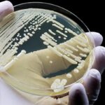 CDC Identifies Four Urgent Superbug Threats Driving Rising Healthcare Costs in the U.S. CDC Identifies Four Urgent Superbug Threats Driving Rising Healthcare Costs in the U.S.