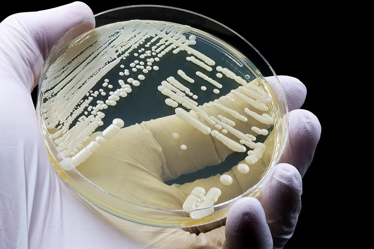 CDC Identifies Four Urgent Superbug Threats Driving Rising Healthcare Costs in the U.S. CDC Identifies Four Urgent Superbug Threats Driving Rising Healthcare Costs in the U.S.