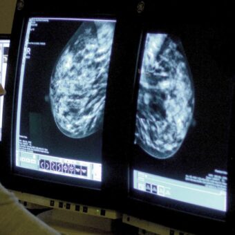 Rising Cancer Rates in Adults Under 50 Spark Urgent Health Concerns Rising Cancer Rates in Adults Under 50 Spark Urgent Health Concerns