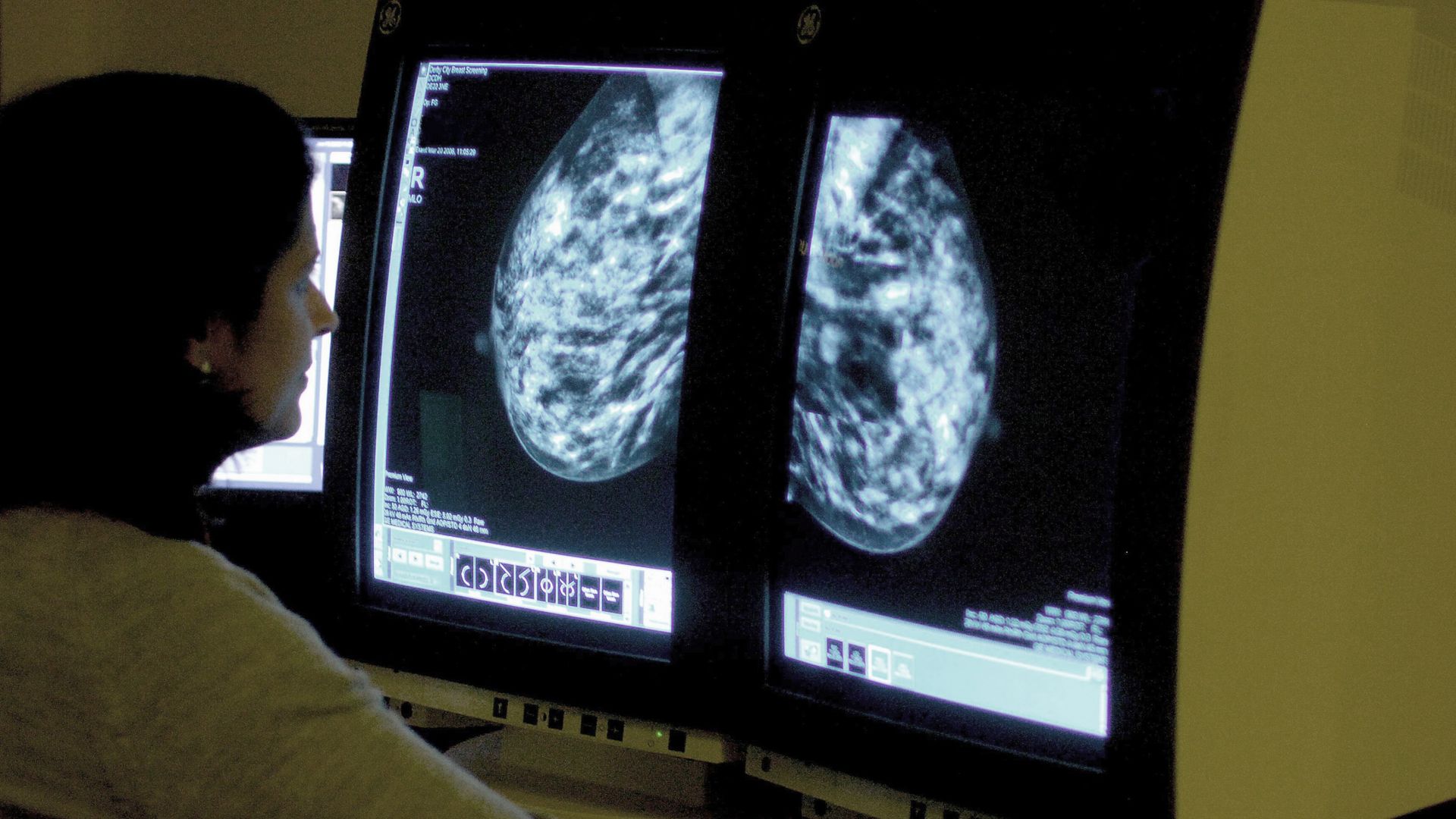 Rising Cancer Rates in Adults Under 50 Spark Urgent Health Concerns Rising Cancer Rates in Adults Under 50 Spark Urgent Health Concerns