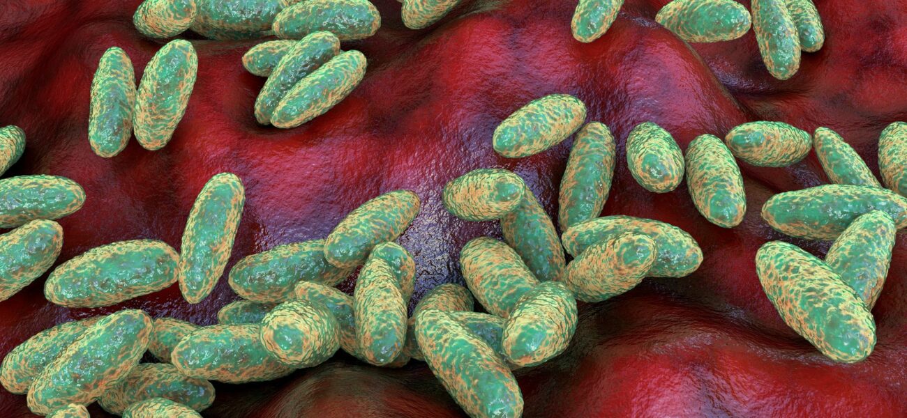 Russia Rejects Second Plague Case Reports as WHO Investigates Lab Death