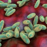 Russia Rejects Second Plague Case Reports as WHO Investigates Lab Death