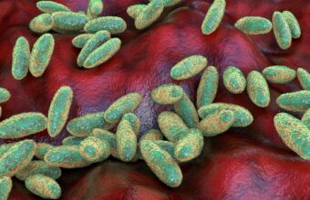 Russia Rejects Second Plague Case Reports as WHO Investigates Lab Death Russia Rejects Second Plague Case Reports as WHO Investigates Lab Death